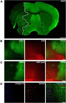 Increasing reproducibility in preclinical stroke research: the correlation of immunofluorescence intensity measurements and Western blot analyses strongly depends on antibody clonality and tissue pre-treatment in a mouse model of focal cerebral ischemia